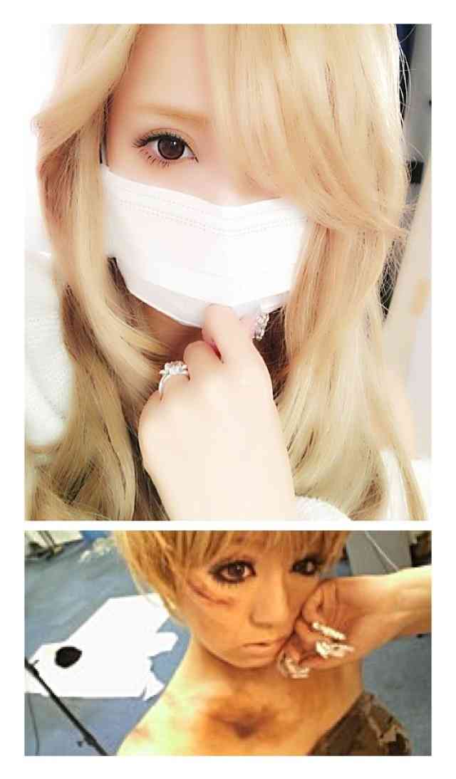 小悪魔agehaモデル・一条ありさ  　浜崎あゆみ目指し整形、キャバクラで1億円稼いだと語る