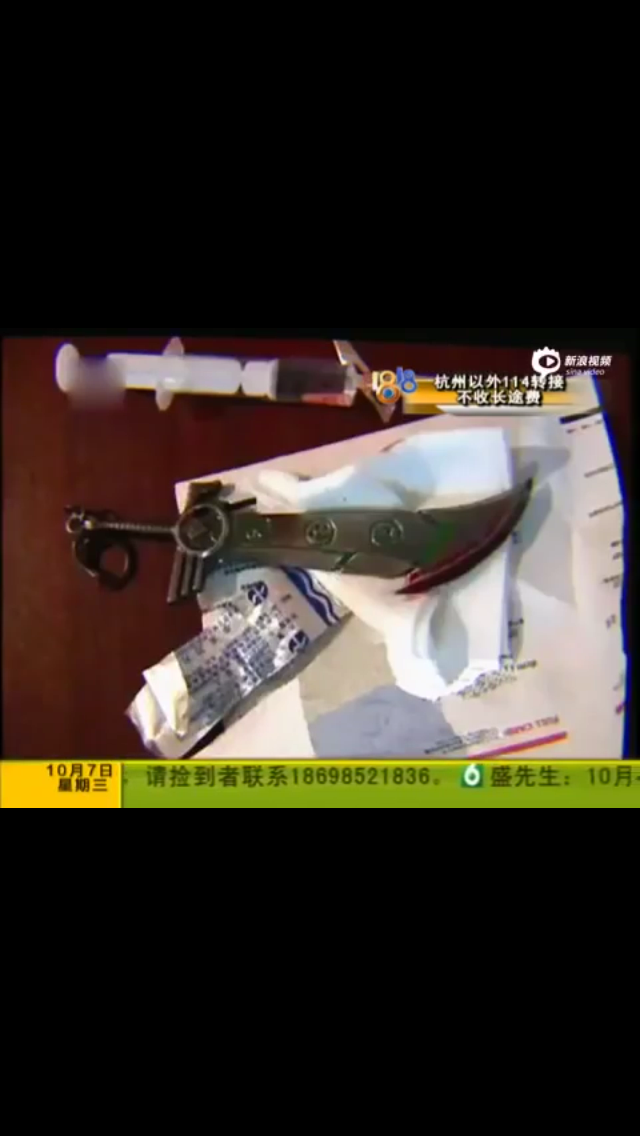 〔下ネタ注意？〕尻にオモチャが刺さった男が病院に現れる → 男「痔を切除しようと思った」→ 医師「痔ではありませんが」