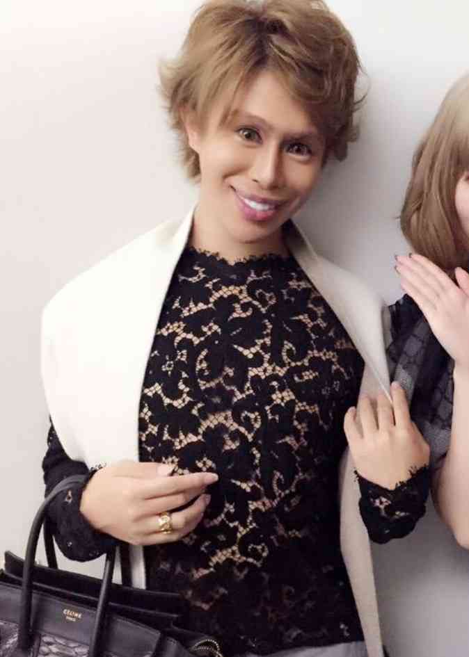 お金しか愛せない!? “日本一美しい整形男子”アレンが語る、整形美学と、パトロンとの甘い生活