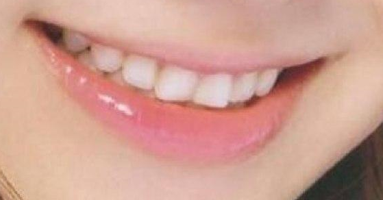 「好きな歯並び」ってありますか？