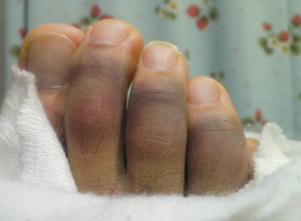 足の指のケア ガールズちゃんねる Girls Channel