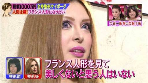「ツルンとバービー人形のようにして！」美容整形で股をまっ平にするNYの女性たち。