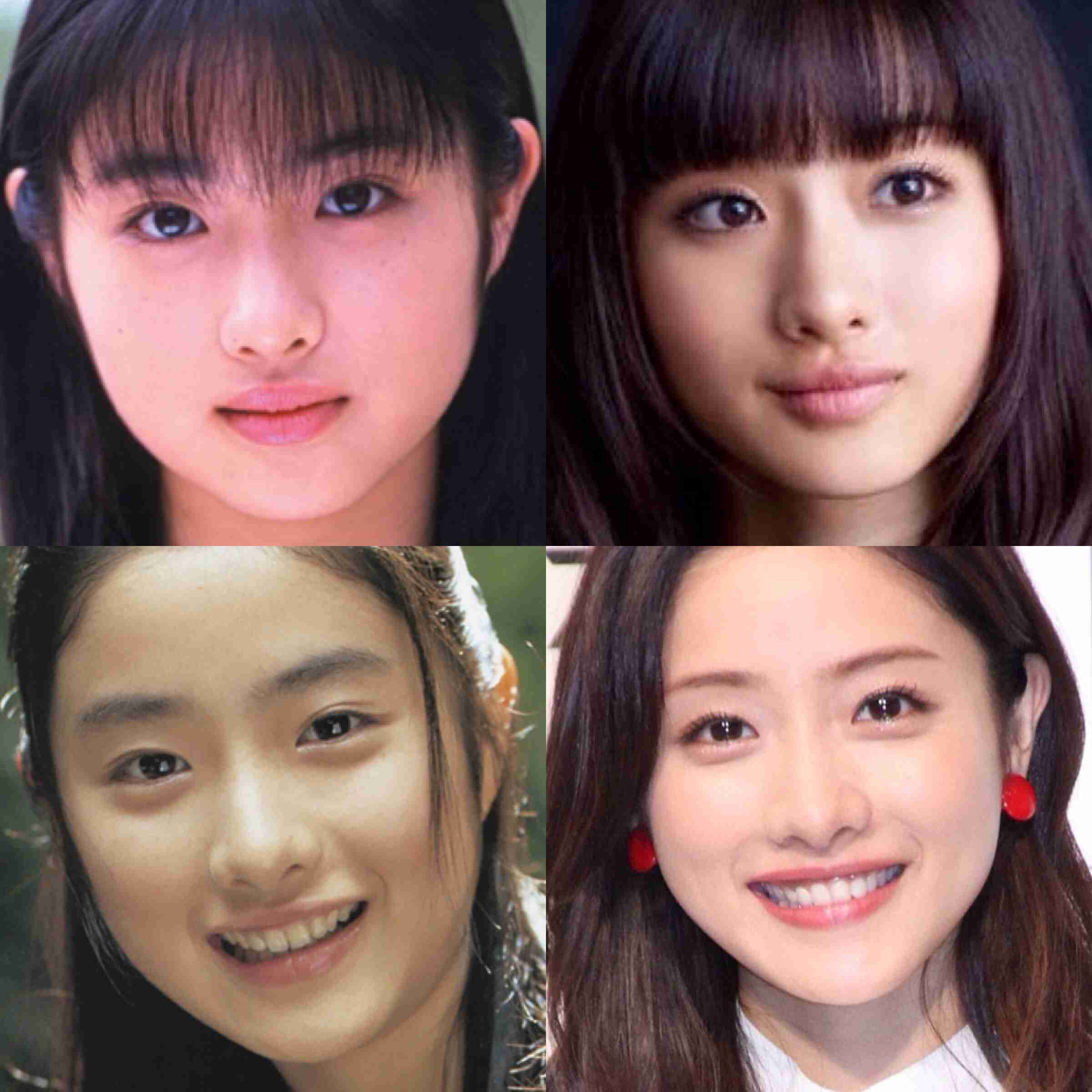 整形してるだろうなと思うけどあまり話題にならない芸能人 ガールズちゃんねる Girls Channel