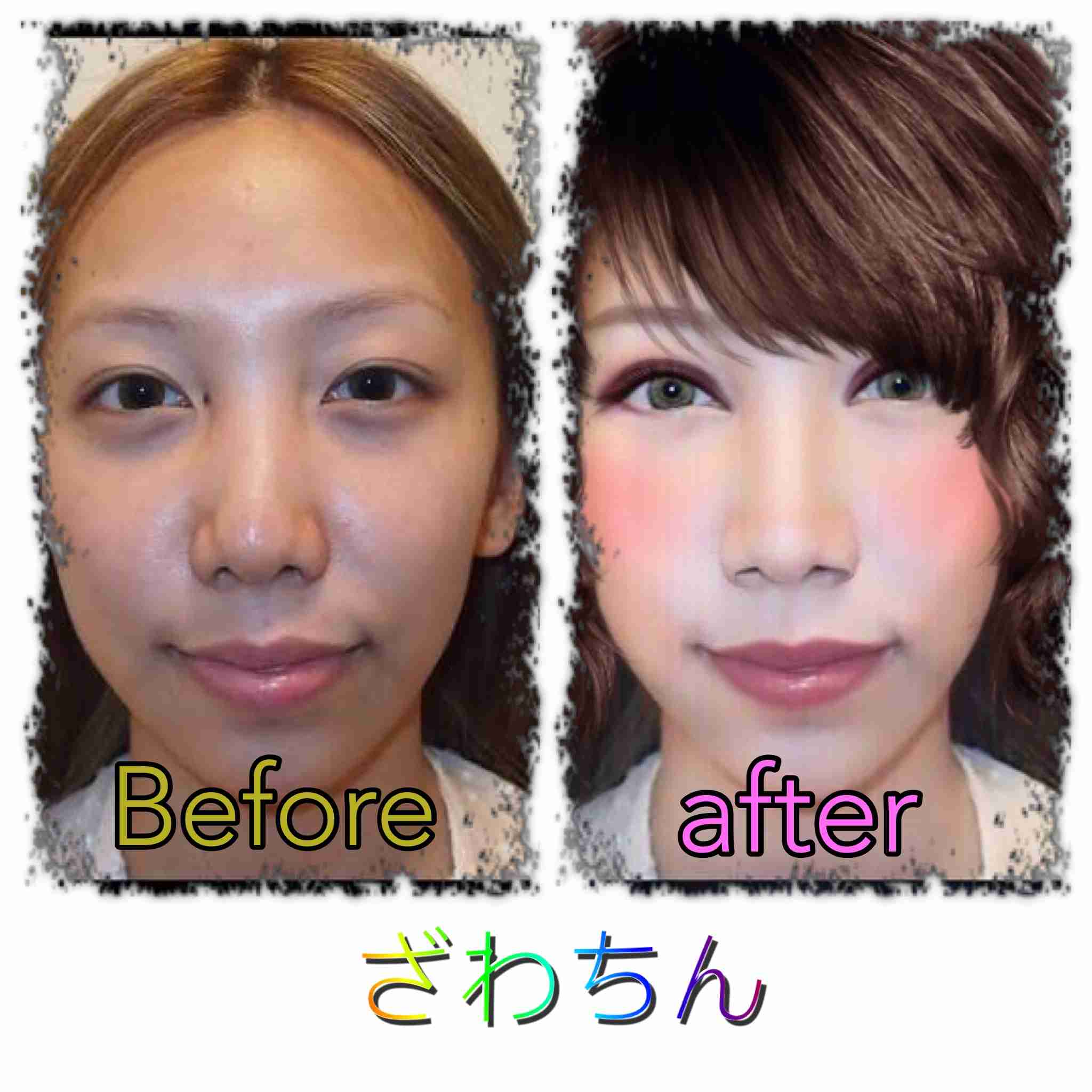 ざわちんの首にキスマーク? 入浴中の写真にファンがざわざわ