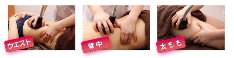 セルライトの取り方を教えて!