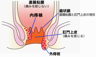 なってから初めて知った病気