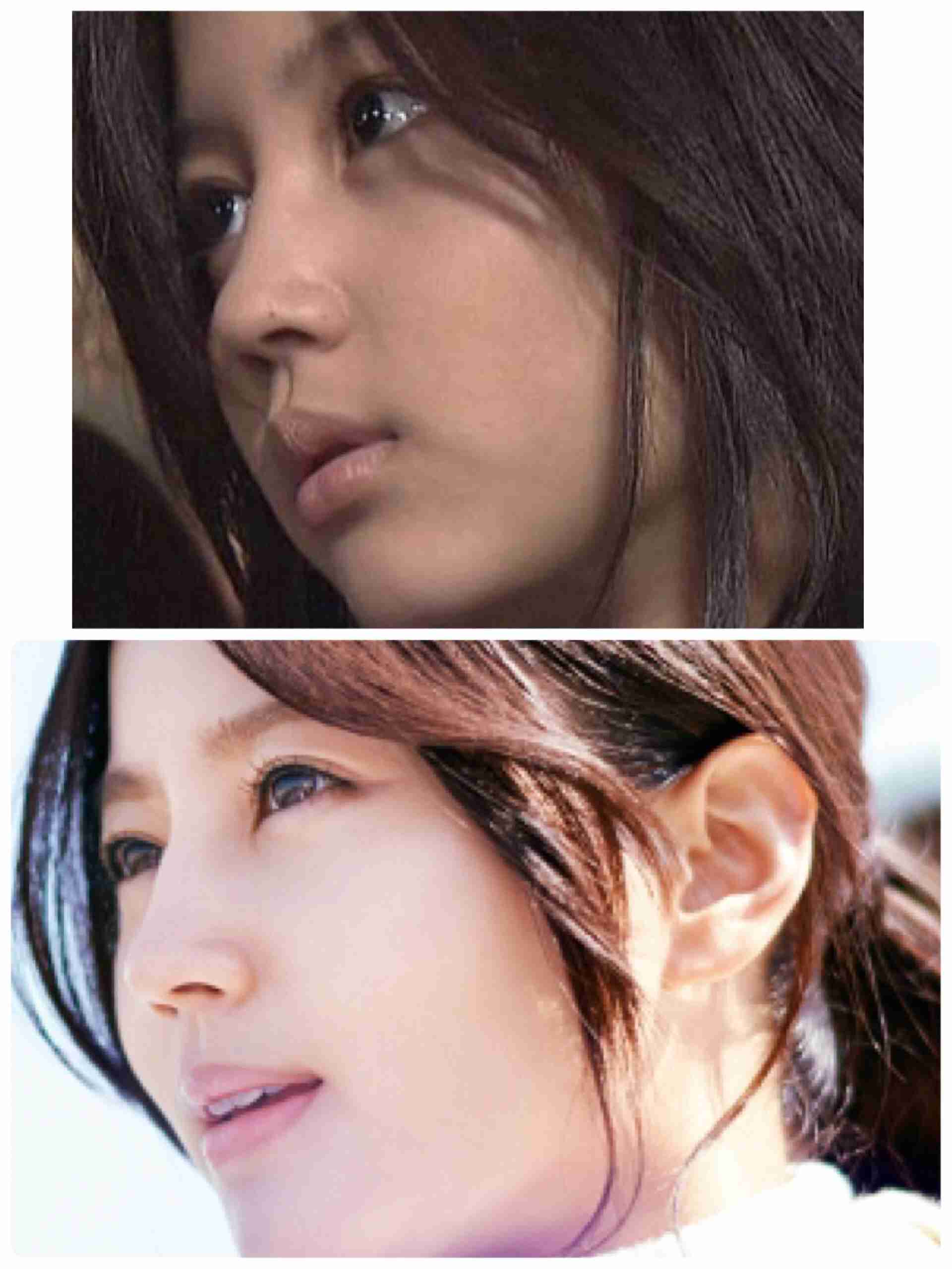 目頭切開していると思う芸能人