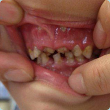 幼児にコーラを飲ませたら他人が「飲ませるな！」と怒鳴ってきた件「無害だし私の子なんだから黙ってて！」