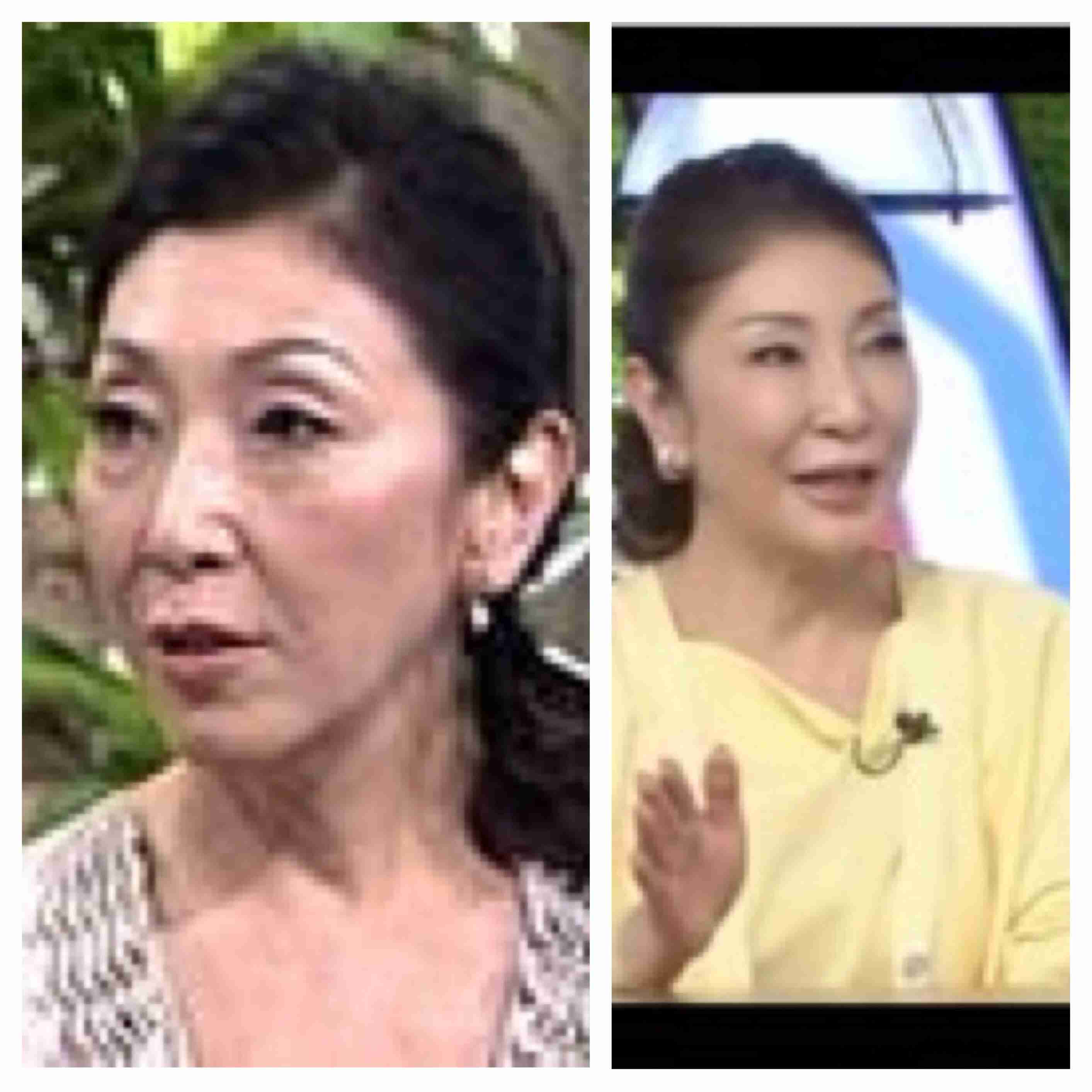 二重以外を整形している芸能人