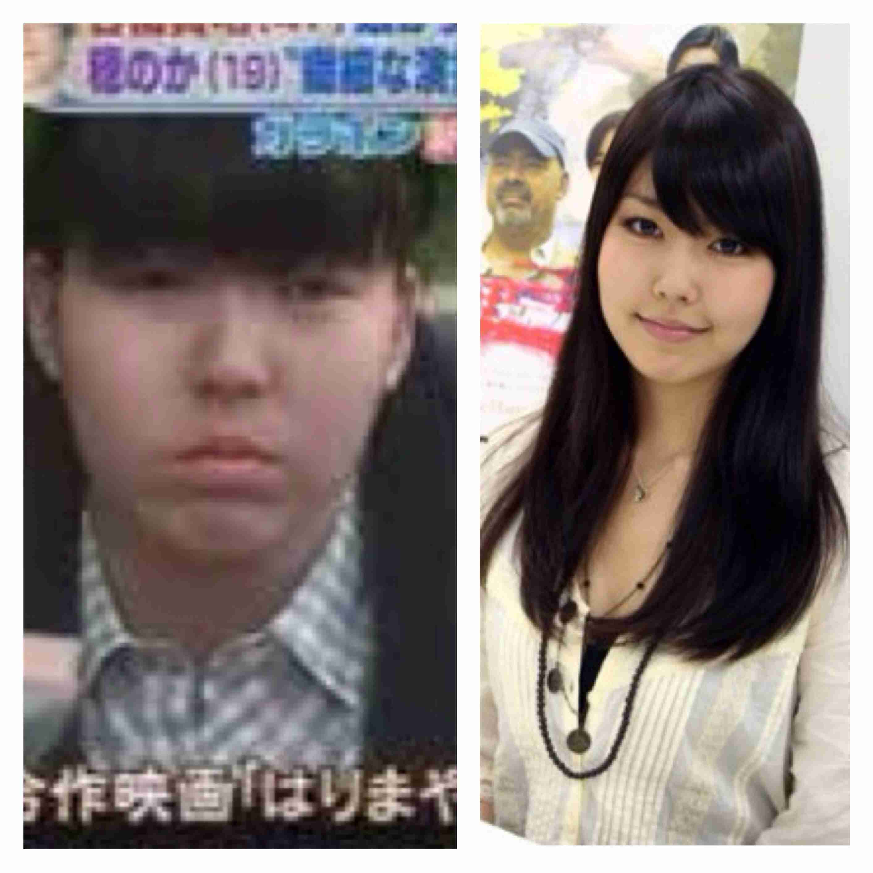 二重以外を整形している芸能人