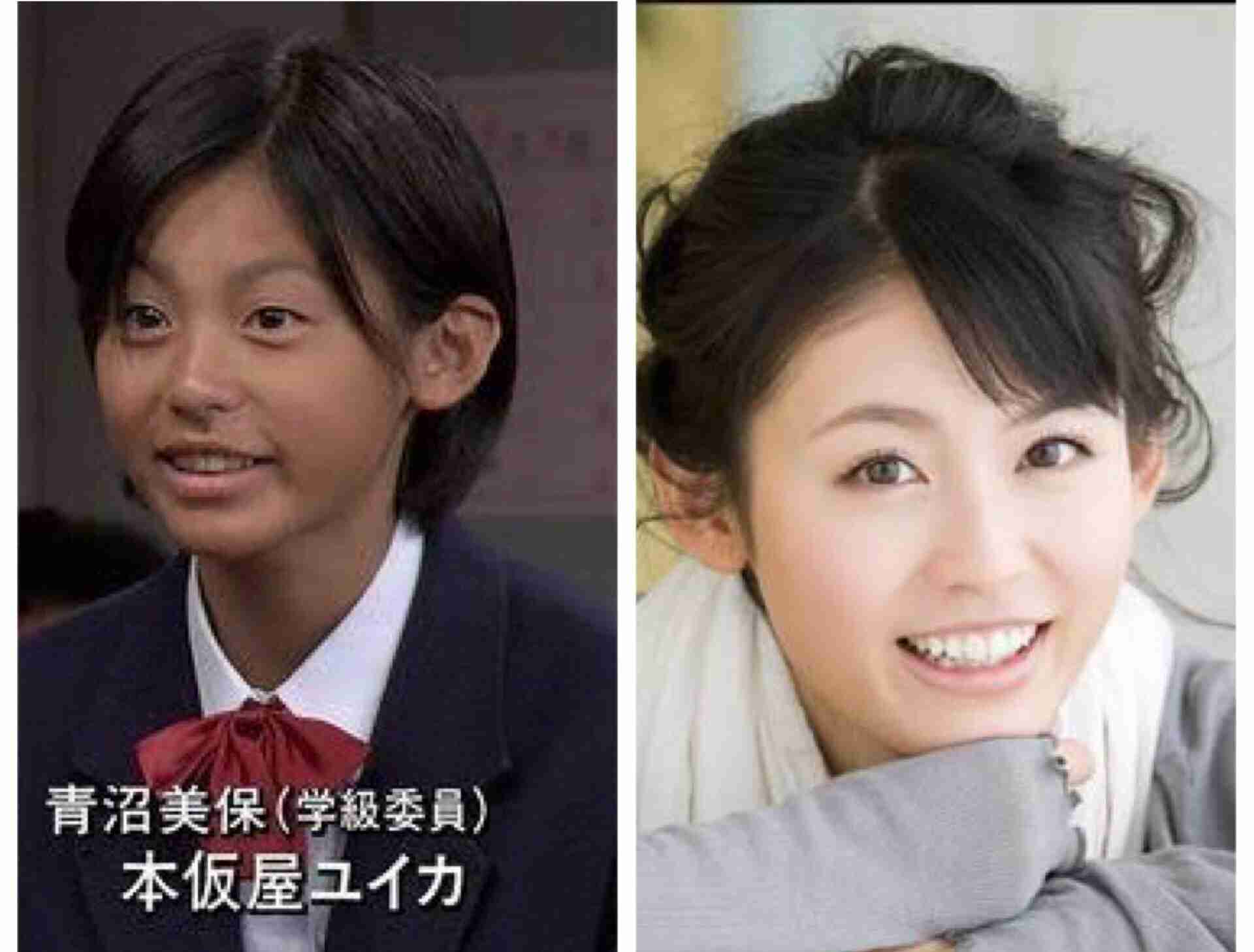 二重以外を整形している芸能人
