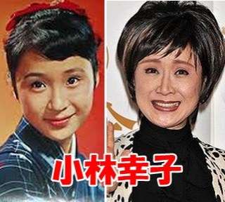 二重以外を整形している芸能人