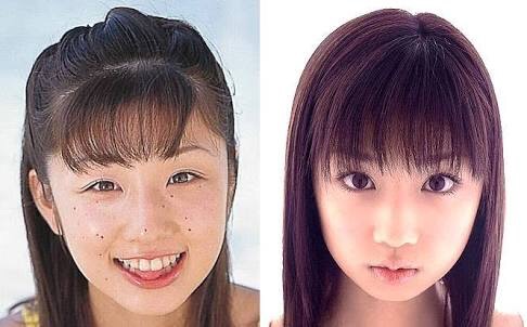 二重以外を整形している芸能人