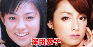 二重以外を整形している芸能人