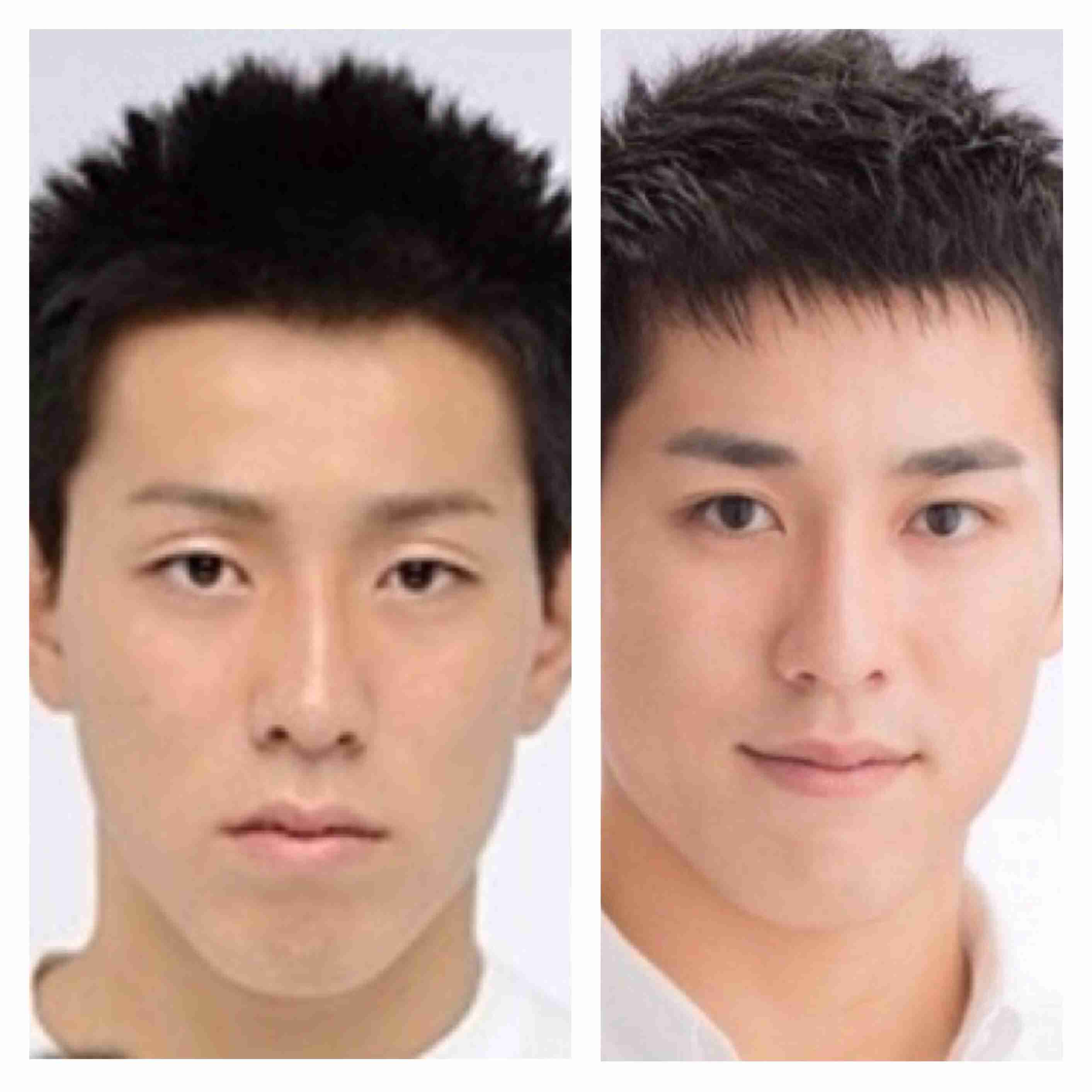二重以外を整形している芸能人