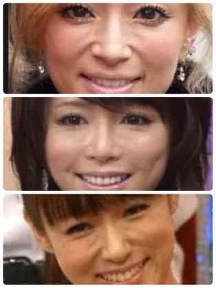 二重以外を整形している芸能人