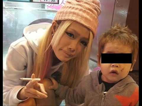 2歳長男にたばこ押し当てた24歳父親に罰金10万円の略式命令