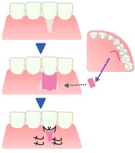 マツコ・デラックス、年末年始は「歯ぐきの移植手術」