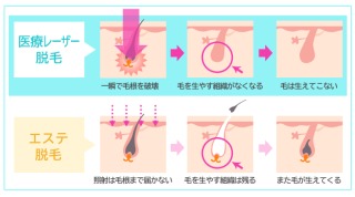 口ひげの処理