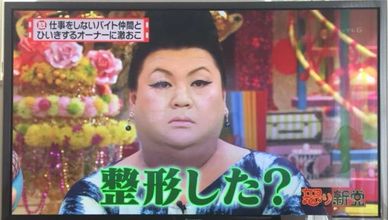 美容整形で失敗した方いますか?