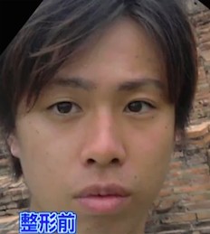美容整形で失敗した方いますか?