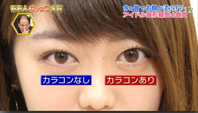 AKB48峯岸みなみ、整形疑惑を完全否定　カラコンで女子力アップ!?