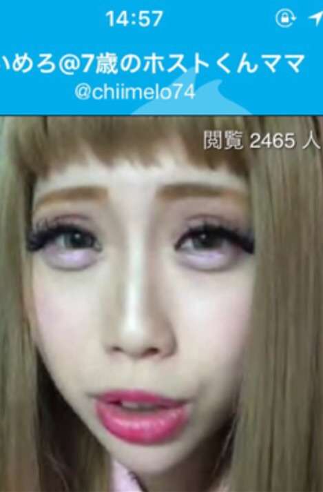 ややグロ整形手術動画もUP、ちいめろの理想は「自然界にあり得ない顔」