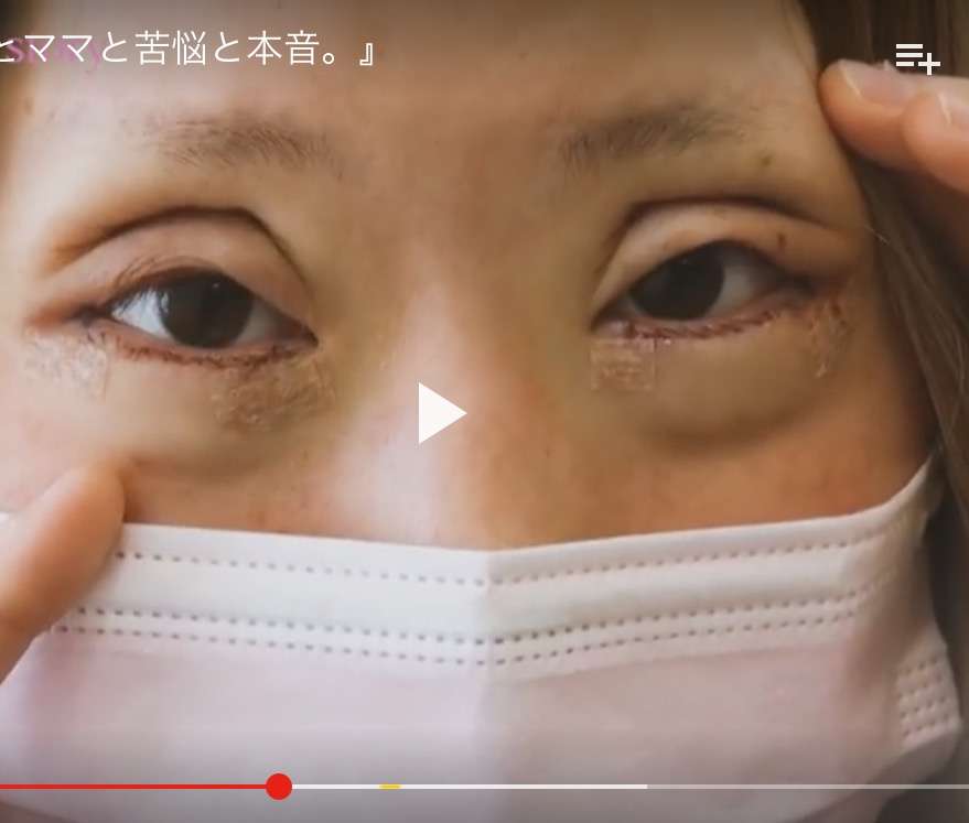 ややグロ整形手術動画もUP、ちいめろの理想は「自然界にあり得ない顔」