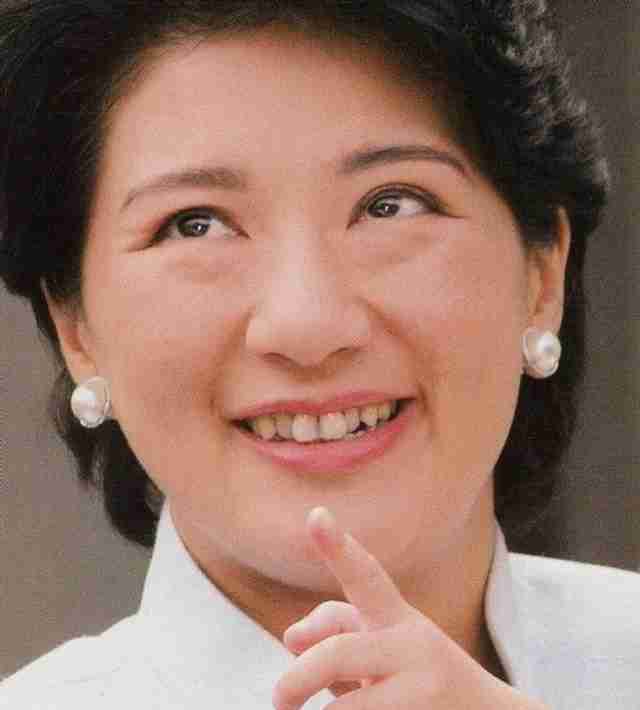 歯並びは治したほうがいいと思いますか ガールズちゃんねる Girls Channel