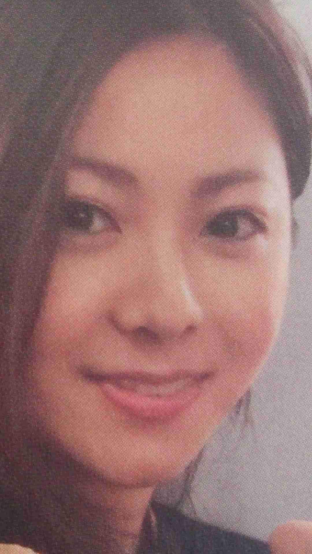 AKB48島崎遥香の鼻が以前と違うと話題に