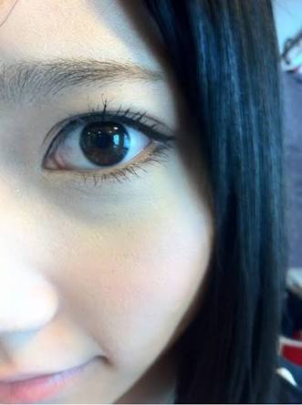 AKB48島崎遥香の鼻が以前と違うと話題に