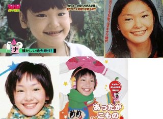 AKB48島崎遥香の鼻が以前と違うと話題に
