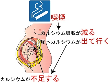 妊娠中に喫煙の母から生まれた赤ちゃん、体重少なく
