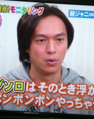髪の薄い芸能人