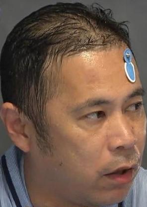 髪の薄い芸能人