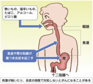 猫舌の人ー！