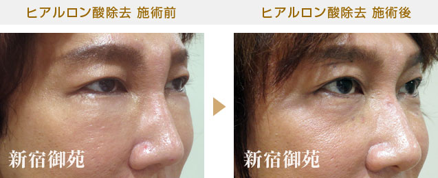 釈由美子が