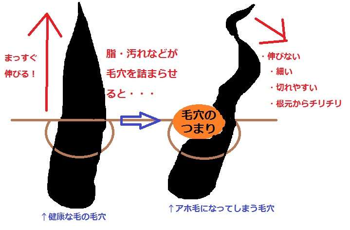 ストレスでついやってしまうこと