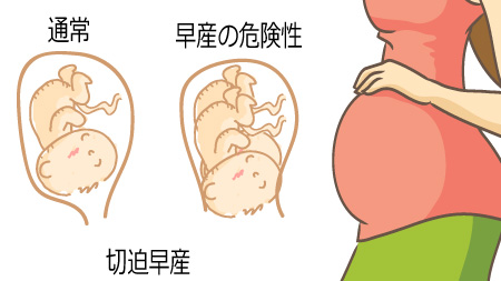 早生まれについて