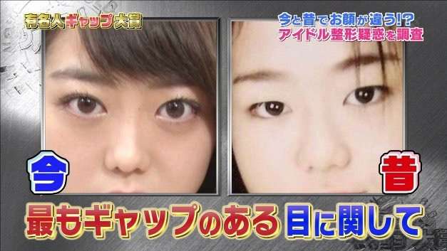 トレンディエンジェル・たかし、AKB48峯岸みなみに「整形してる」と断定?!