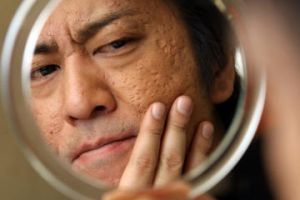 最強に敏感肌な人、集まれ!