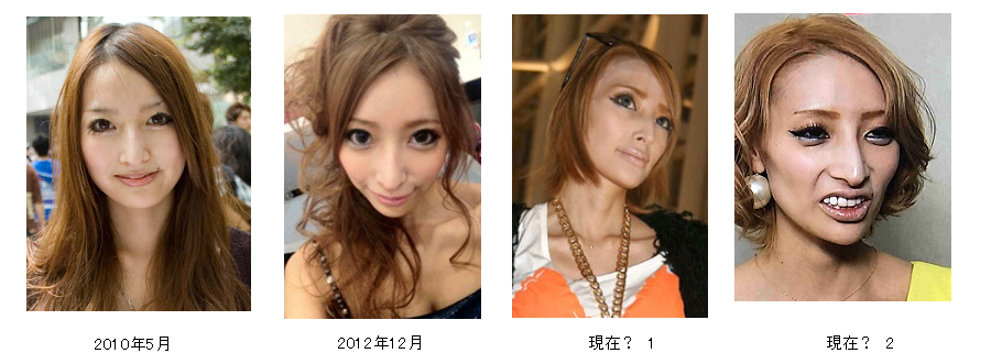 生まれもっての整形顔