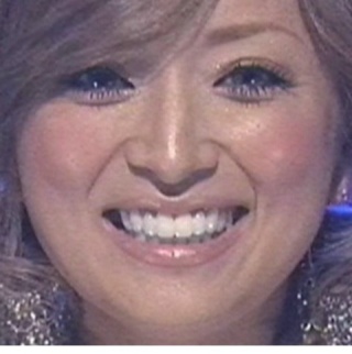 人の歯気になりますか？