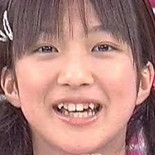 人の歯気になりますか？