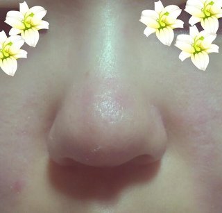 だんご鼻でも可愛い芸能人