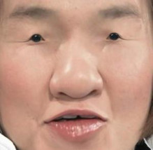 だんご鼻でも可愛い芸能人
