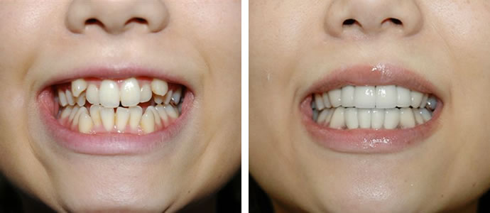 彼氏、旦那の嫌な外見指摘できますか？