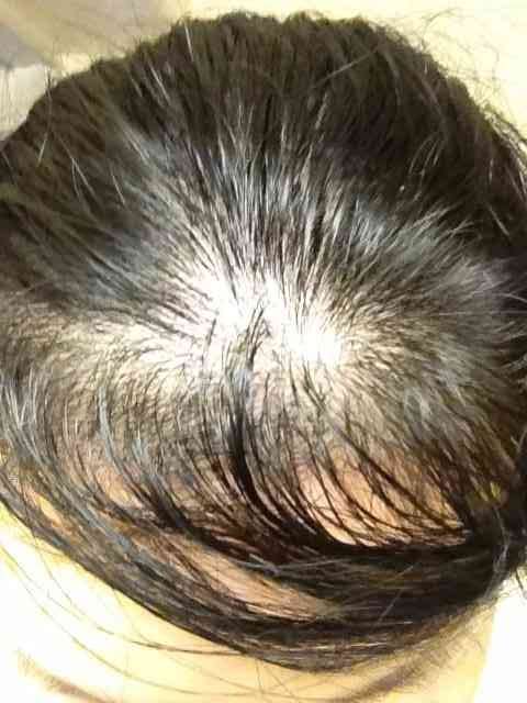 女性で薄毛細毛のかた、どんなヘアケアしてますか？