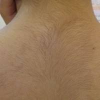 背中キレイですか ガールズちゃんねる Girls Channel