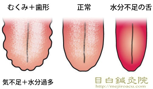 水分過剰摂取気味の方！